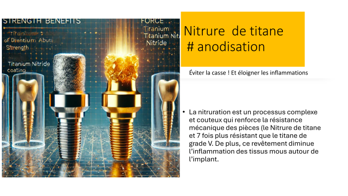 Pourquoi IPD depuis 2004-4